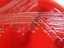 En la placa d'agar sang observem el creixement del bacteri Listeria monocytogenes, com colònies petites, arrodonides, i d'un color blanquinós.