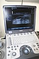 Ultralydscanner til undersøgelse af halsen