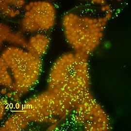 Kolonie von Microcystis wesenbergii unter dem Epifluoreszenzmikroskop, DNA mit SYTOX[4] grün gefärbt