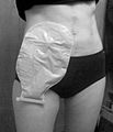 Ostomy bag