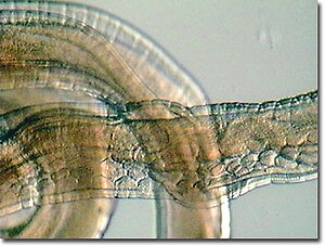 편충 숫컷(Trichuris trichiura)