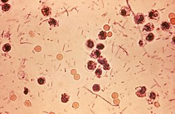 Shigella