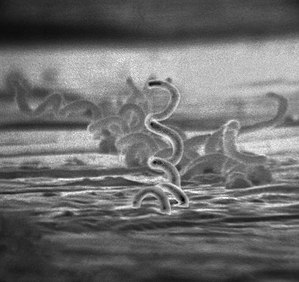 Ηλεκτρονική μικρογραφία ωχράς σπειροχαίτης, του βακτηρίου που προκαλεί τη σύφιλη.