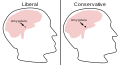 In the 2011 study by neuroscientist Ryota Kanai (n=90 students), the subjects who expressed conservative views (right) tended to have a larger amygdalae (1) than the students who expressed liberal views (left).