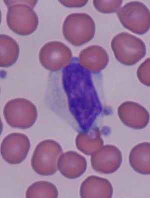 English: Reactive lymphocyte surrounded by Red...
