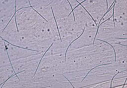 Visió a través d'un microscopi, unes quantes espores en forma de fil es veuen distribuïdes pel camp de visió.