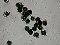 Foto al microscopio de esporas mojadas de Equisetum Los eláteres están enrollados alrededor de las esporas.