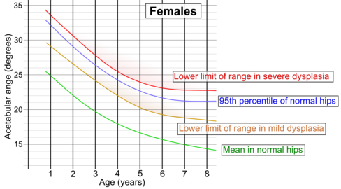 Acetabular index by age in females.[8]