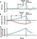 Miniatura para Neurociencia del libre albedrío