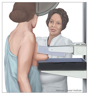English: Mammography in process: Shown is a dr...