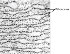 By using electron microscope, ribosomes ("particles") on the rough endoplasmic reticulum can be observed 0313 Endoplasmic Reticulum b en.png