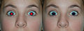 Demonstration of automated red-eye removal with GIMP software. Before (L); After (R).