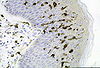 Dendritične celice v koži