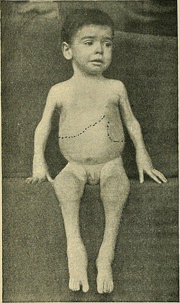 Description de l'image The diseases of children - medical and surgical (1900) (14781042361).jpg.