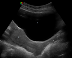 Ultraschallbild von 1: Harnblase; 2: Gebärmutter; 3: Vagina