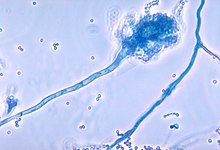 Image showing the conidiophore of the fungal organism Aspergillus fumigatus—the most common cause of chronic pulmonary aspergillosis.