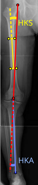 Кут стегно-коліно-кісточка.