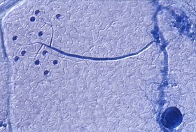 Hifa de Hyaloperonospora parasitica crescendo no interior da folha de Arabidopsis thaliana, vista ao microscópio.