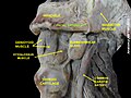 Dissection du cou montrant l'artère faciale. Vue de profil.