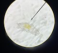Tardígrado bajo microscopio