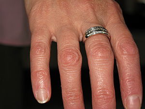 English: Wedding anniversary diamond ring.