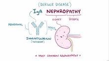 File:IgA Nephropathy.webm