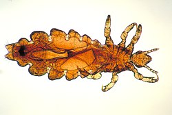 Head louse, from Wikipedia