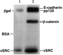 SDS-PAGE autoradiography - The indicated proteins are present in different concentrations in the two samples. SDSPAGE.png