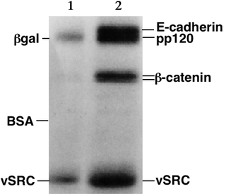 Gel de SDS-PAGE