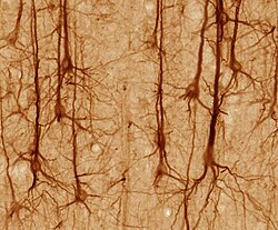 SMI32-stained pyramidal neurons in cerebral cortex Smi32neuron.jpg