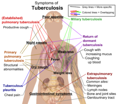 Symptoms of Tuberculosis