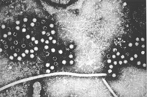 Зображення вірусу гепатиту Е