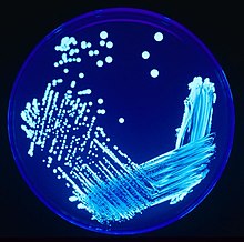 An agar plate with bacteria spread by the streak plate method. Colonies de legionelles.jpg