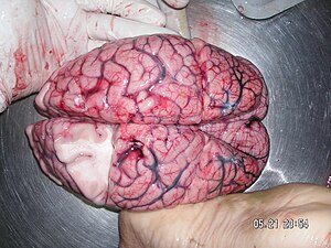 Human brain taken from autopsy.
