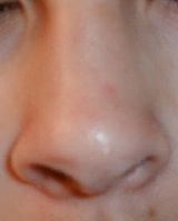 [1] Eine menschliche Nase