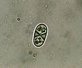 Caloplaca feracissima (microscoop-opname)