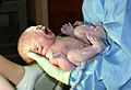 Una neonata pochi secondi dopo la nascita