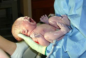 Newborn child, seconds after birth. The umbili...