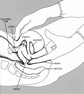 Pelvic exam nci-vol-1786-300.jpg