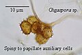 Spiny to papillate auxiliary celles fromt a species of Gigaspora.jpg