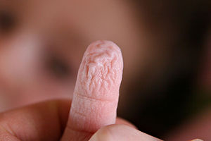 A wrinkled finger after a warm bath