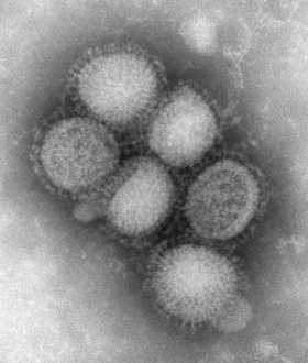 Eletromicrografia de vírions de Influenzavirus A (H1N1) (família: Orthomyxoviridae)