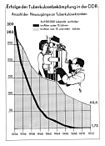 Erfolge der DDR bei der Bekämpfung der Tuberkulose