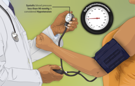 Depiction of a hypotension (low blood pressure) patient getting her blood pressure checked.png