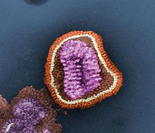 Virus influenza, dilihat dengan mikroskop elektron