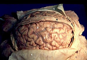 Human brain arachnoid description