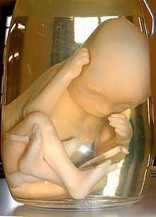 http://upload.wikimedia.org/wikipedia/commons/thumb/3/3c/Human_Fetus.jpg/220px-Human_Fetus.jpg