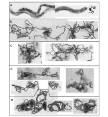 TEM Images of the progressive collapse of the magnetosome chain structures in cells. Magnetosome collapse.png