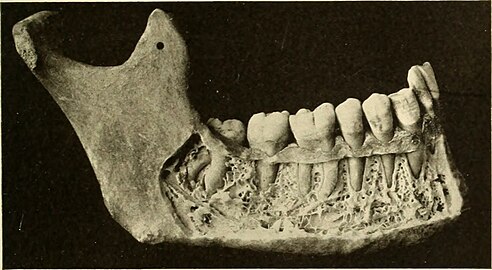 Cutaway view showing spongy bone