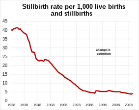 Stillbirth rate in England and Wales